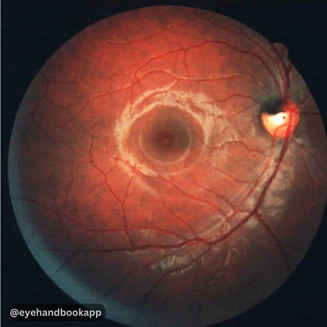 Eye Handbook tweet media