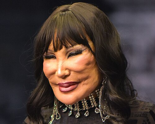 NenaVelasco32's tweet image. Ésta mujer está en constante competencia con @alitomorenoc ¡El #botox los ha deformado!
Cada día ¡ambos! parecen hermanos de #LynMay 😖