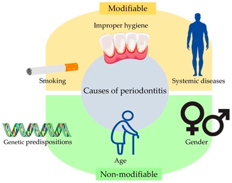 IJMS_MDPI's tweet photo. 💡Check out our interesting article related to the Hot Topics "#Metalloproteinase"
📕Importance of Metalloproteinase 8 (MMP-8) in the Diagnosis of #Periodontitis
🧑🔬Emilia Anna Zalewska, et al
🔗https://t.co/9JUaNiF18v
#MDPIIJMS #OpenAccess #MMP8 #hottopic #oraldisease https://t.co/21Hrqr1O99