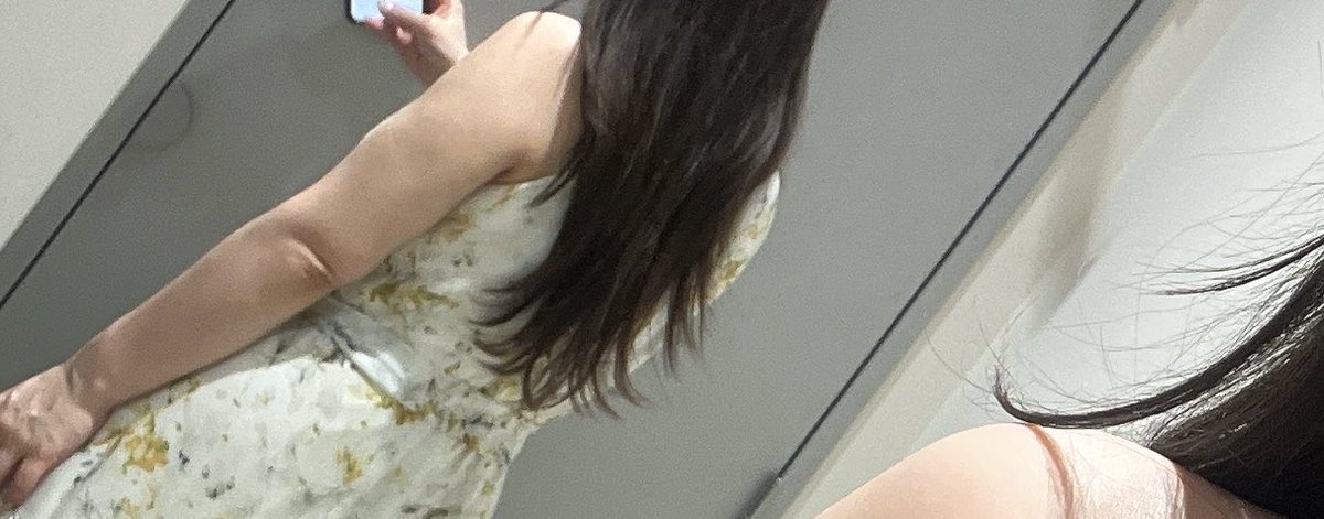 pasokonkun0507's tweet photo. 二の腕脂肪吸引後の、こういう弛み？よぼつきには何が効果的なんだろう😢
明らかによぼついてるよね…
脂肪の量多かったし太ってたから失敗とは思わないけど、
どうしよう〜 https://t.co/fIwwINrNYg