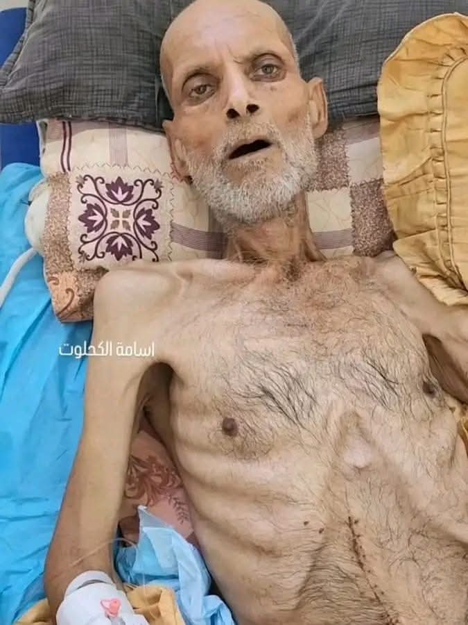 Yousef in Gaza 🇵🇸 tweet media