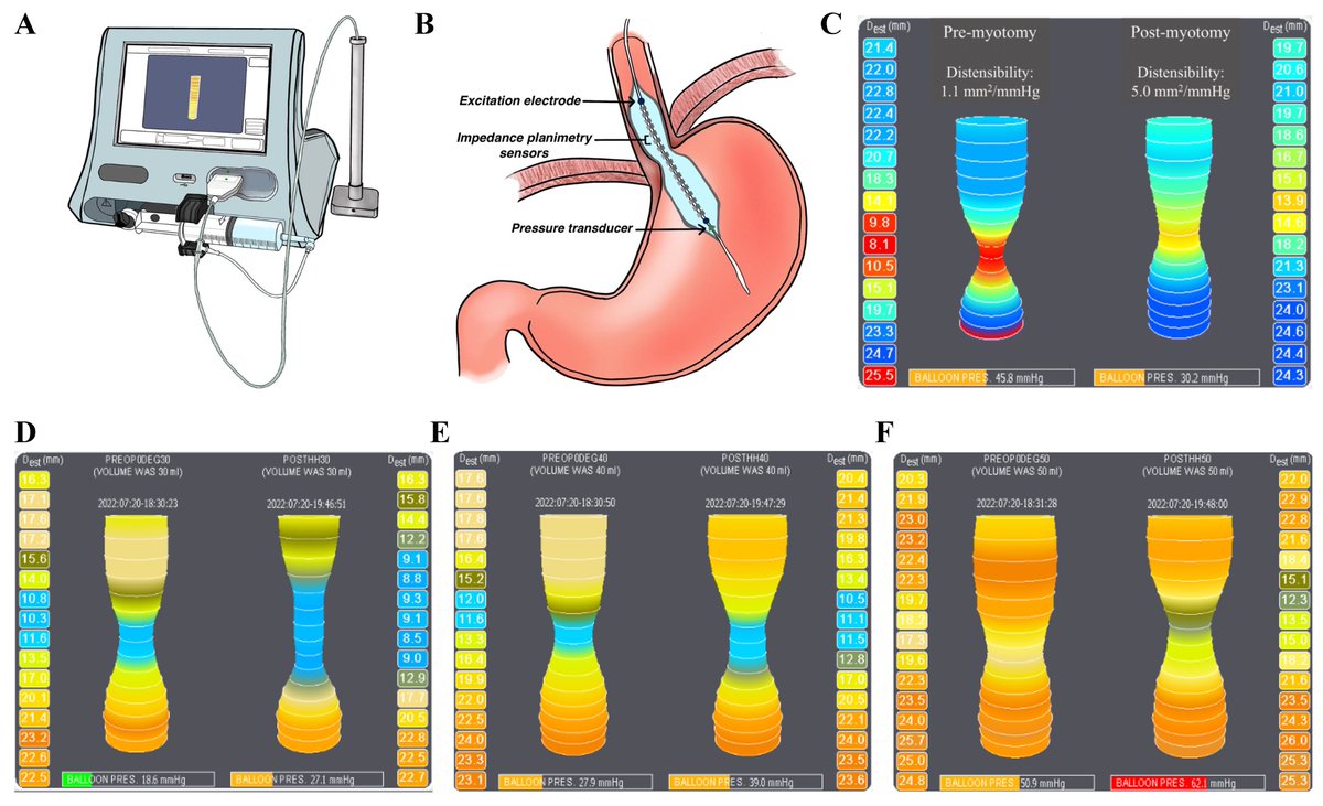 Mini-invasive Surgery tweet media