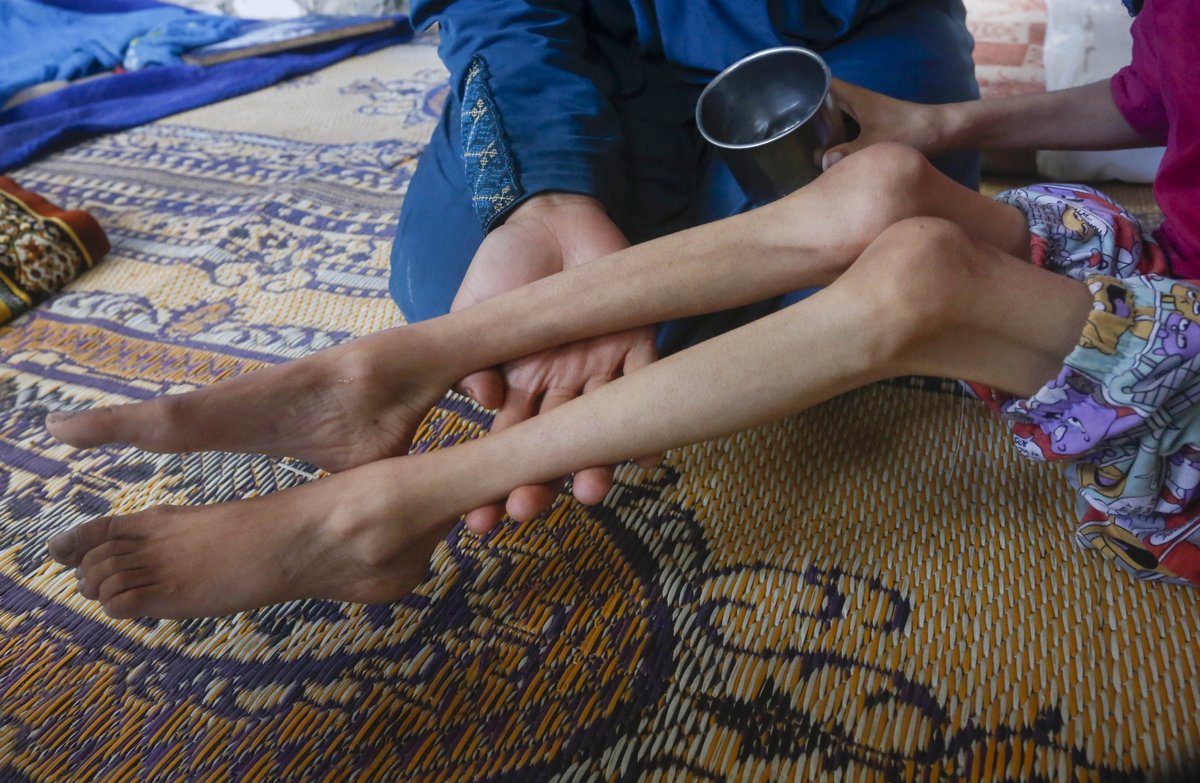 Privar a las personas refugiadas de Palestina de alimentos, agua y recursos básicos es un método de presión y una grave violación de los derechos humanos. Y en #Gaza sigue ocurriendo. En un solo año, al menos 463 palestinos incluidos 157 niños han muerto por inanición.
¡Basta ya!