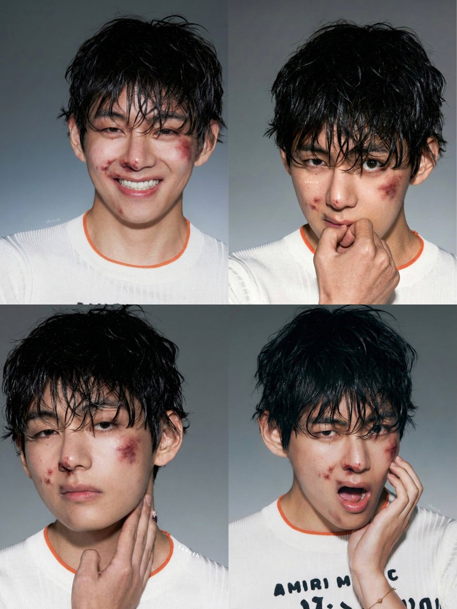 KIM TAEHYUNG YOU ARE CRAZY FOR THIS