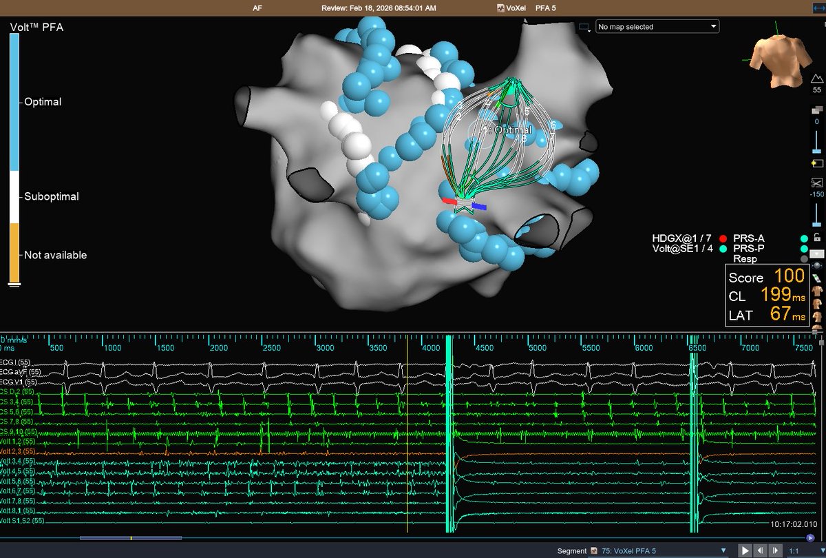 peterkistler MBBS PhD FHRS tweet media