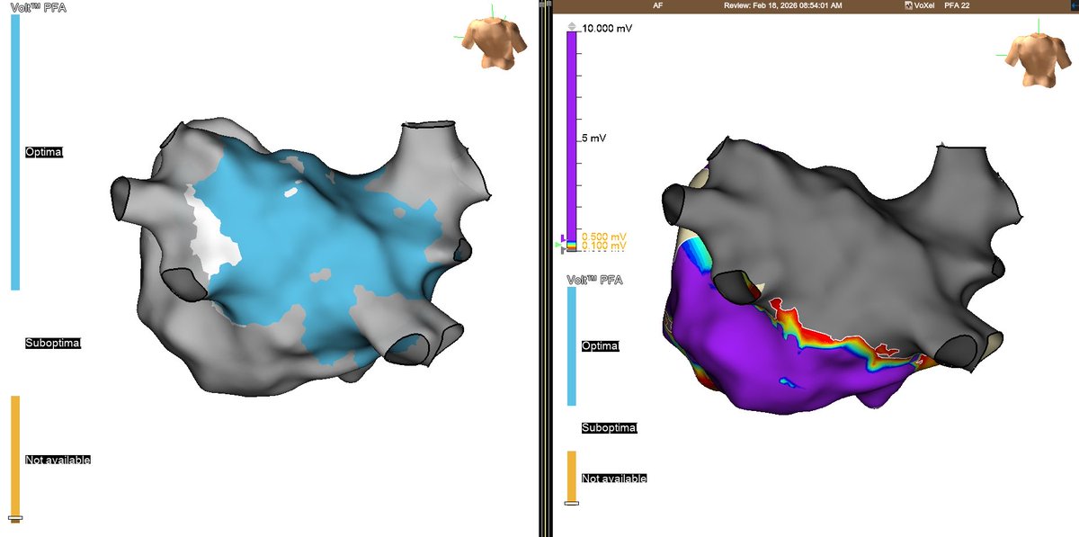 peterkistler MBBS PhD FHRS tweet media