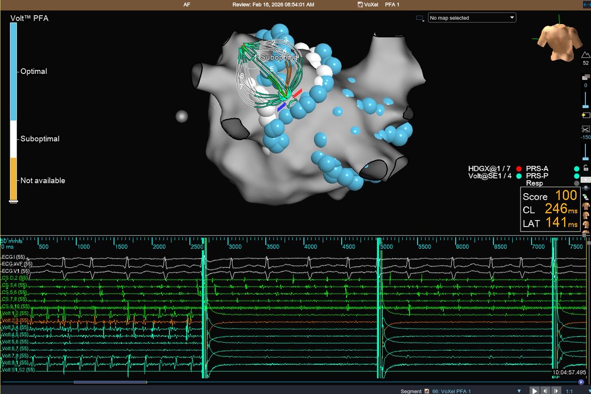 peterkistler MBBS PhD FHRS tweet media