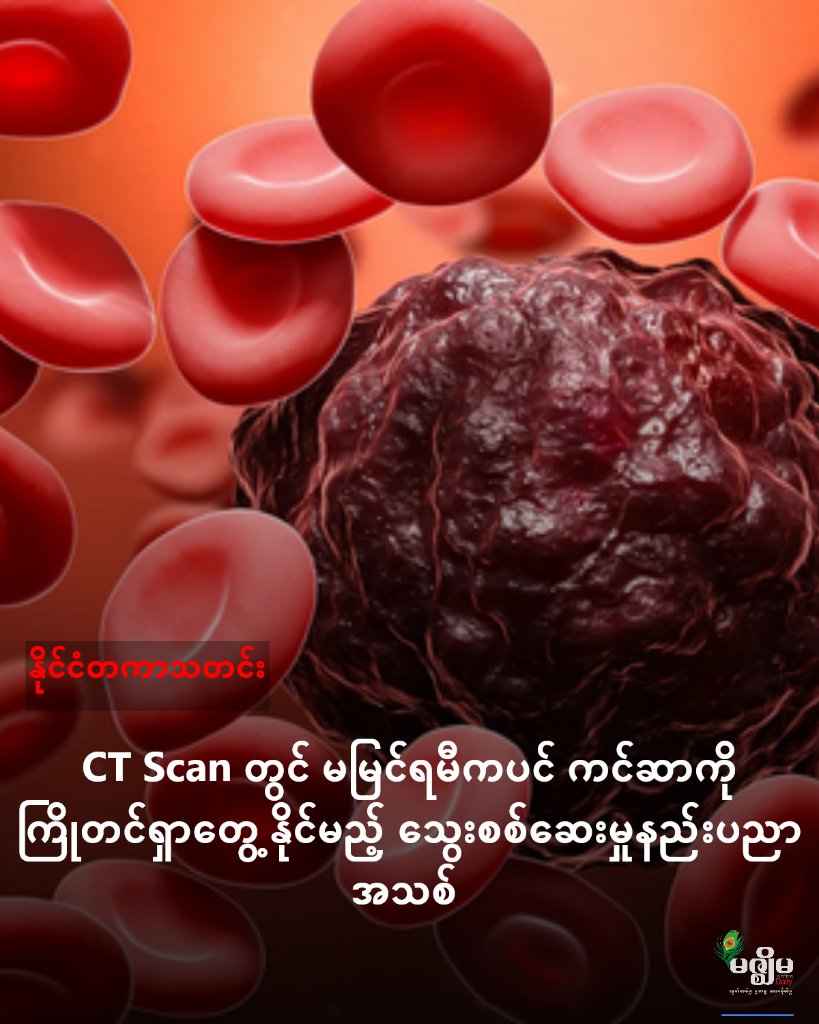 MizzimaNews's tweet image. CT Scan တွင် မမြင်ရမီကပင် ကင်ဆာကို ကြိုတင်ရှာတွေ့နိုင်မည့် သွေးစစ်ဆေးမှုနည်းပညာ အသစ်

website link &amp;gt;&amp;gt; bur.mizzima.com/2026/02/18/822…
#CT_Scan
#သွေးစစ်ဆေးမှုနည်းပညာ
#ကင်ဆာ
#မဇ္ဈိမသတင်းဌာန
#MizzimaBurmeseNews