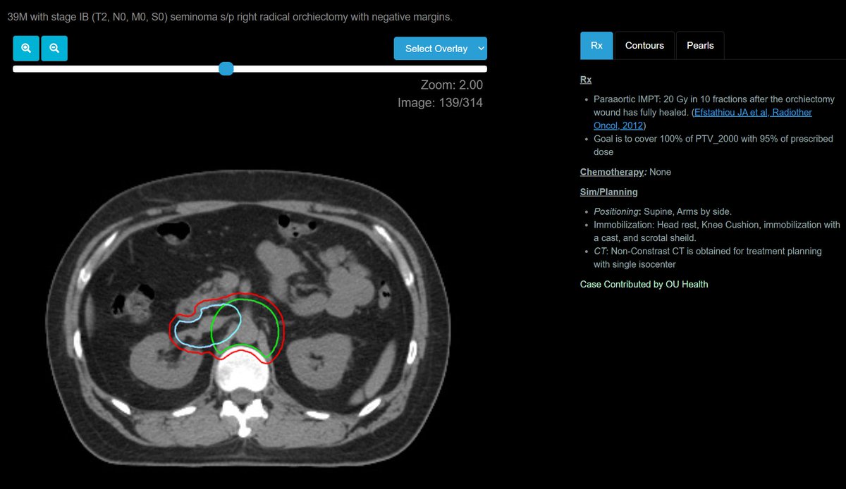eContour tweet media