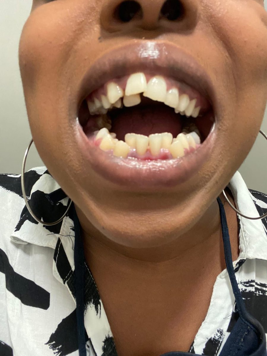 kgadi♠️ tweet media