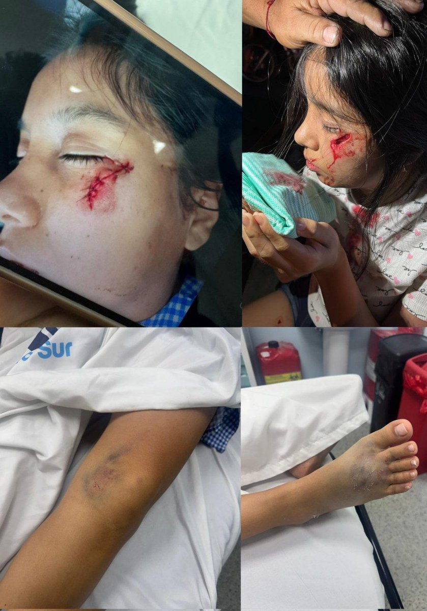 LaCamachoEc's tweet photo. ¿Quien pone orden la #Corrupcion de la @FiscaliaEcuador #BlancaNoblecilla?
@PoliciaEcuador se pasan un PARE a exceso de velocidad en Pedro Pablo Gómez, impactando a un vehículo particular. La gran mentira: El parte dice 20km/h y "operativo antinarcóticos". El video muestra otra https://t.co/LMuyynKfOT