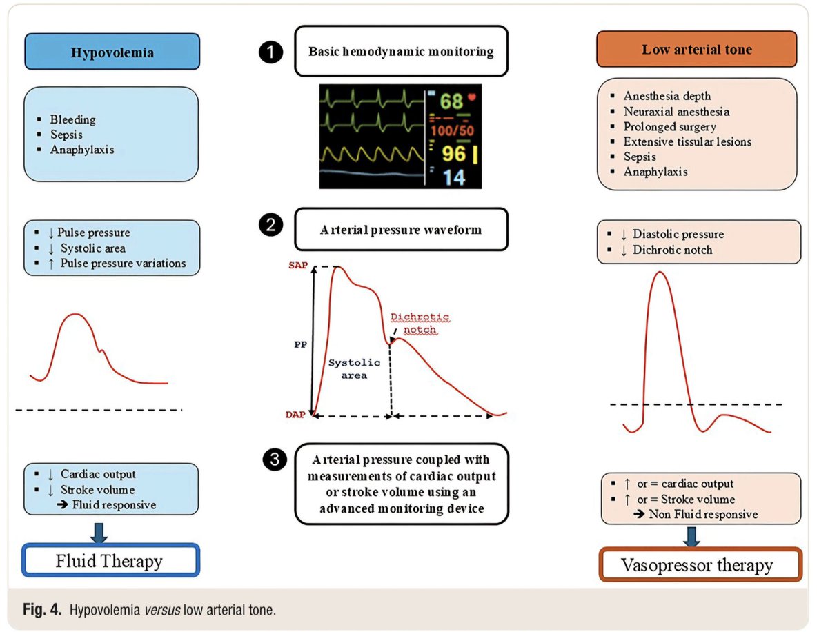 Manejo perioperatorio de vasopresores en pacientes sometidos a cirugia no cardiaca.

Anesthesiology 2026; 144:670–82.

DOI: 10.1097/ALN.0000000000005820

#anesthesia #anestesia #surgery #cirugia #pressure #quirofano #perioperative #urgency #health #salud