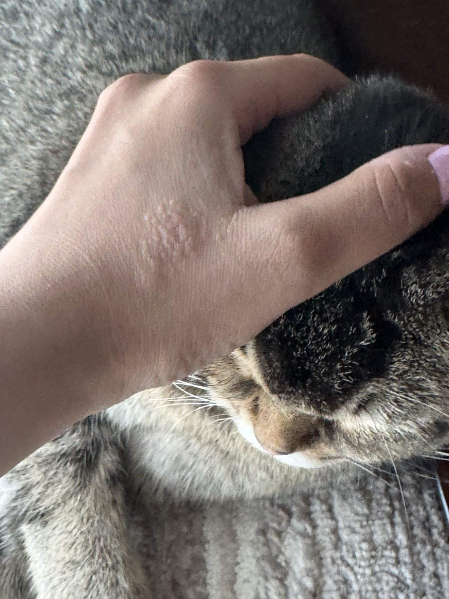 Sometimes you gotta ignore that allergy and pet the meow