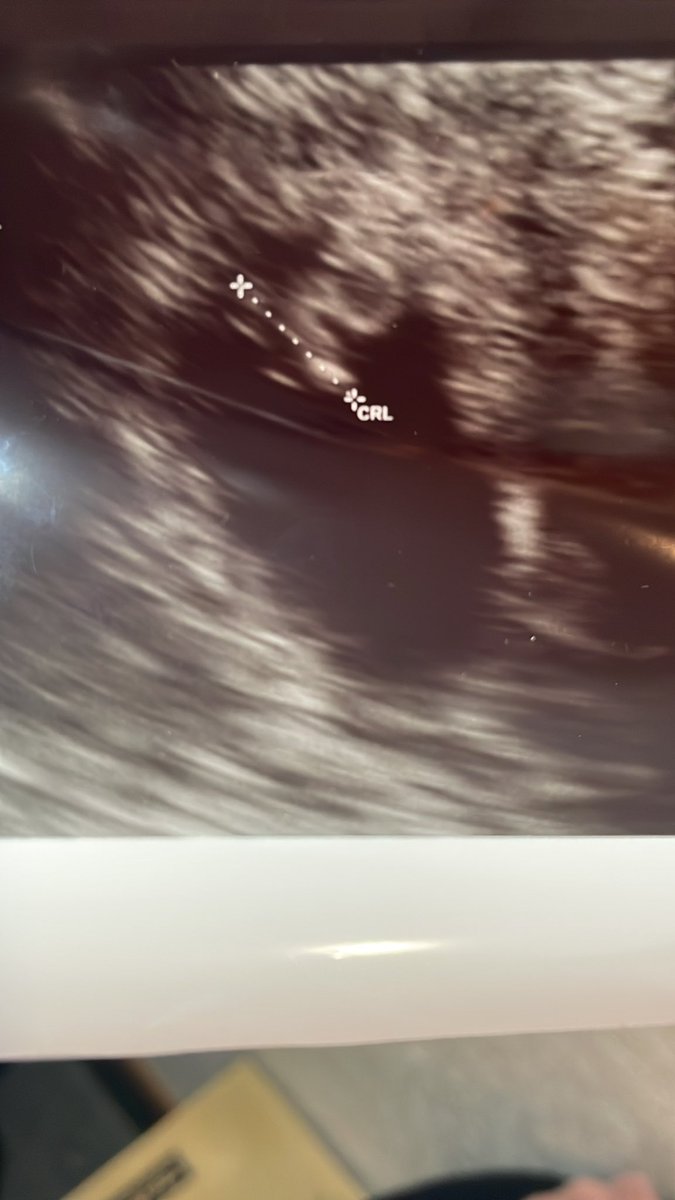 いんこらぶ(あ~ちゃん)🐥🫶💕︎︎ tweet media