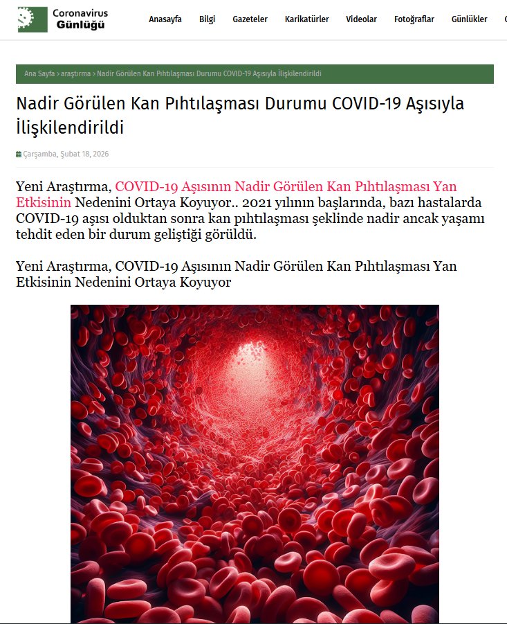 Nadir Görülen Kan Pıhtılaşması Durumu #COVID-19 Aşısıyla İlişkilendirildi..
coronavirusgunlugu.blogspot.com/2026/02/nadir-… 
#pıhtı #coronavirusgünlüğü #covi̇d19