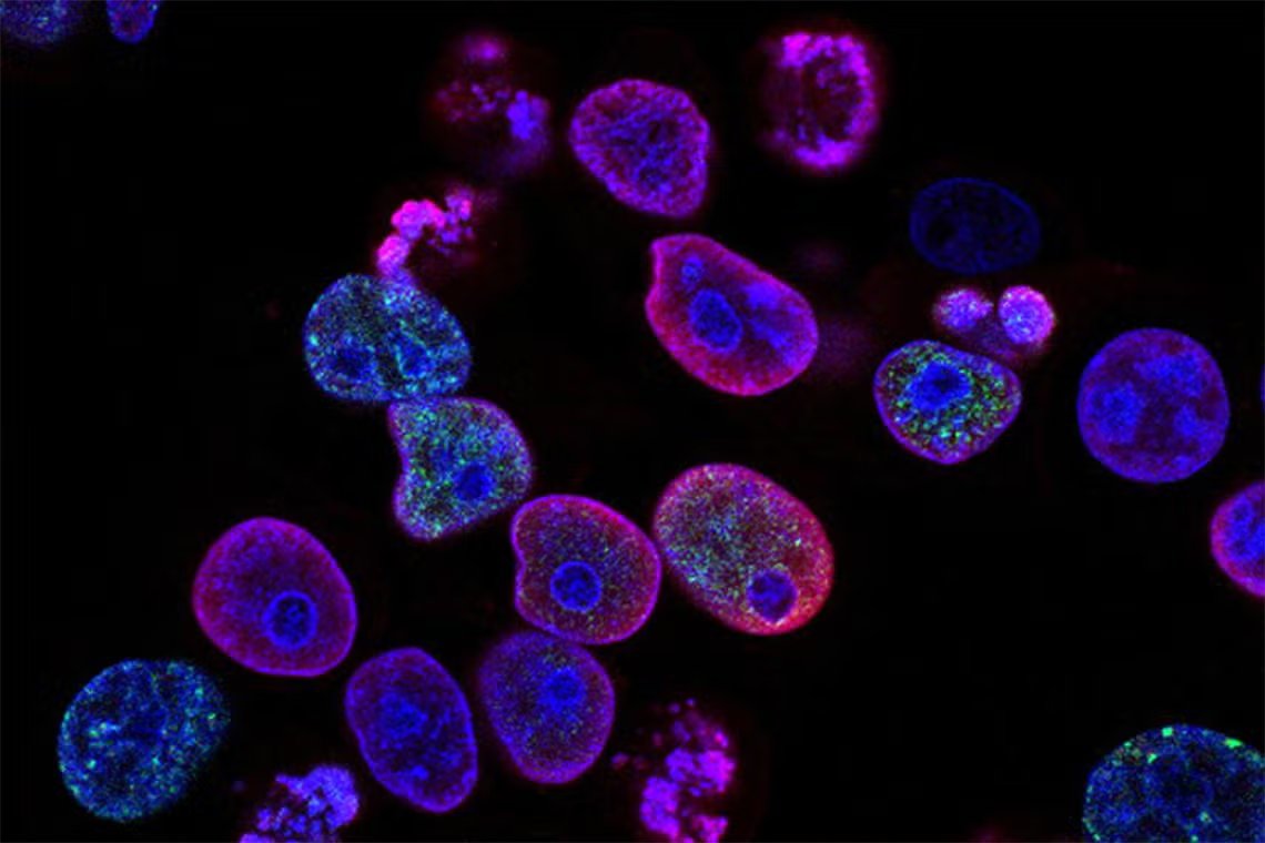 🚨: Light just killed 99% of cancer cells without chemotherapy or radiation