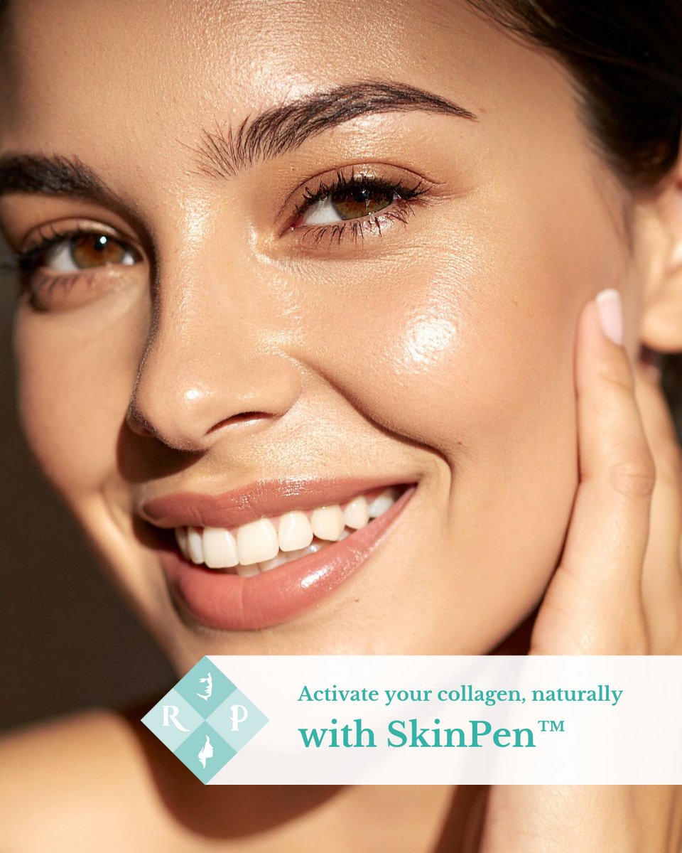 aesthetictreats's tweet image. 🔑 Activate your collagen, naturally.

#SkinPen is a #microneedling treatment that stimulates your skin’s repair process. The device creates micropunctures in the #skin, increasing blood flow and activating fibroblasts to produce #collagen.

👉 Read our latest blog for more.