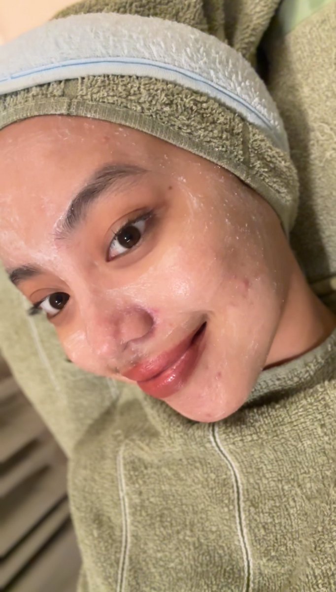 STOP ❌

kulit jerawatan tuh GAK BOLEH ASAL FACIAL☝️ aku baru sadar setelah kemarin facial khusus acne dan ini beda banget😩👍
