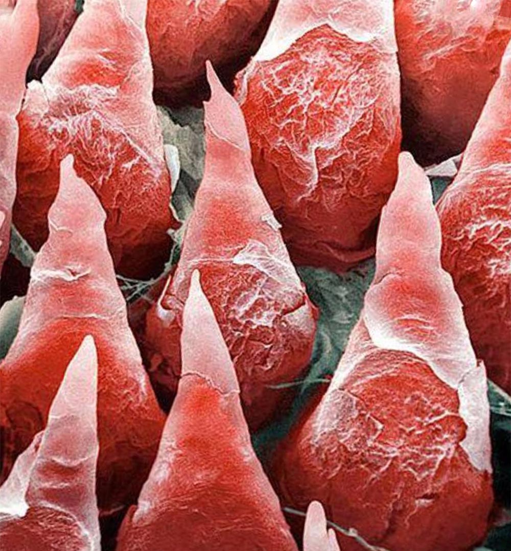 BigBangSciCom's tweet image. Les papilles d'une langue humaine vues au #microscope électronique à balayage

Crédits : ?

#Anatomie #Anatomy #HumanBody #CorpsHumain #Biologie #Biology #SVT