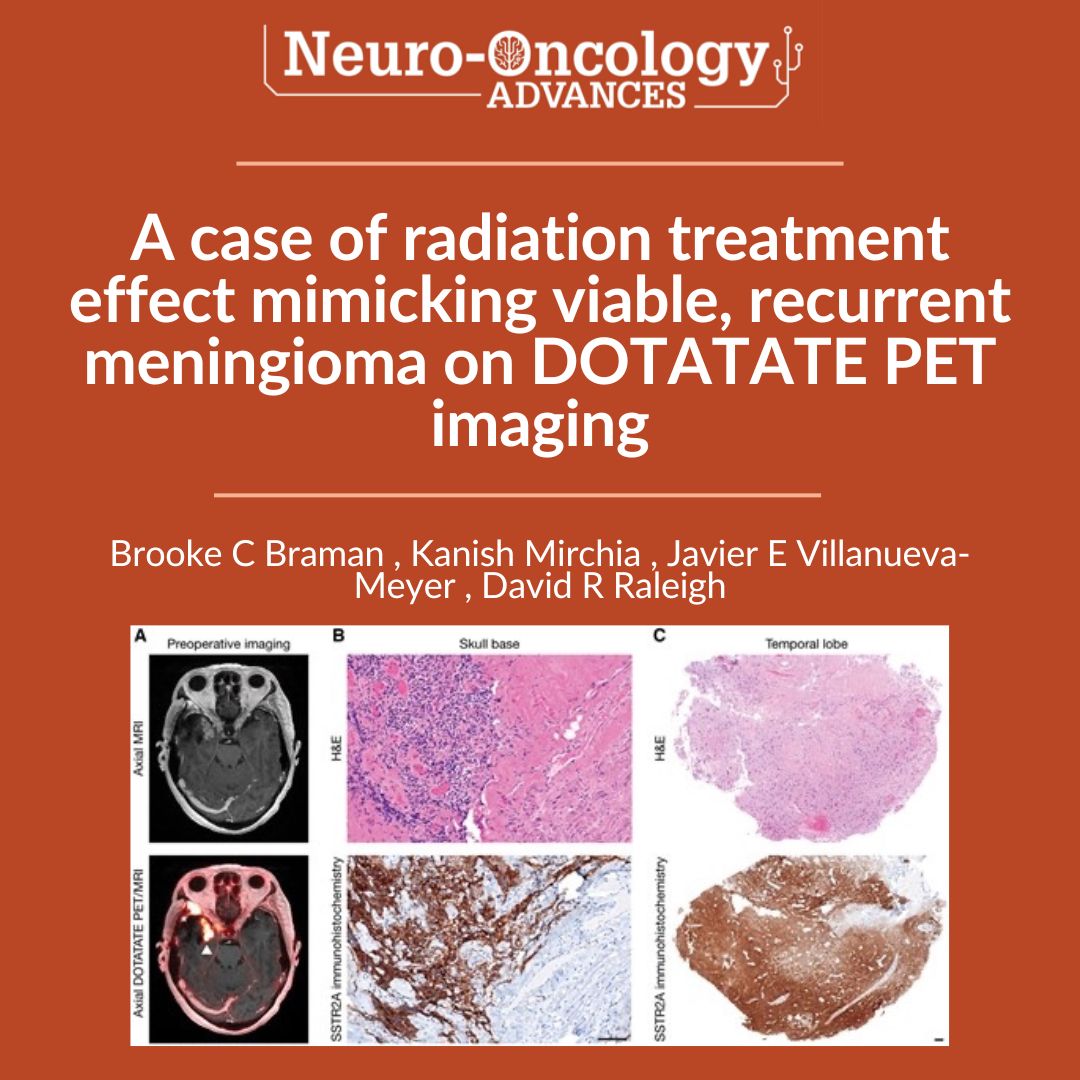 Editor - Neuro-Oncology Advances tweet media