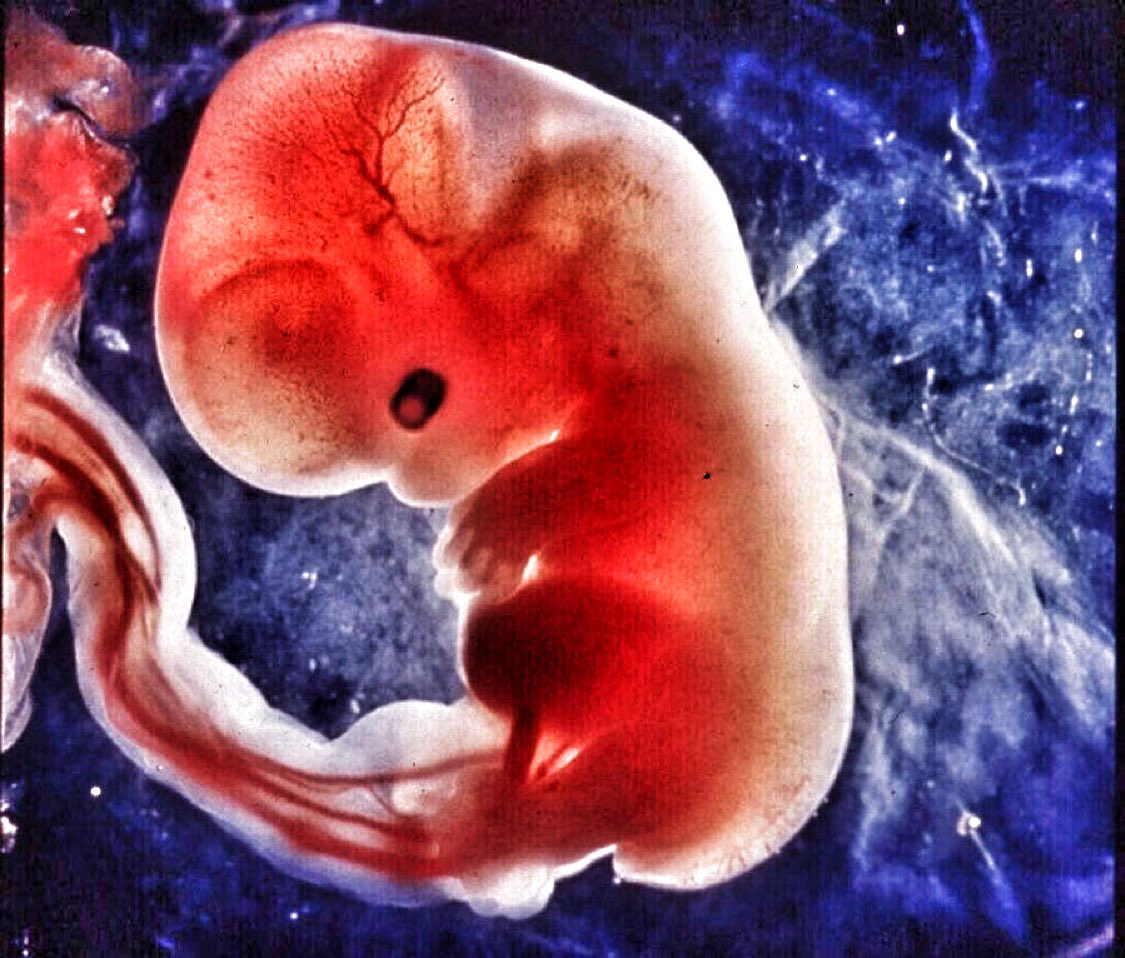 El corazón empieza a latir a los 21 días desde la concepción. Eso ni es ideología, ni es religión, es biología básica. 
#SiAlaVida