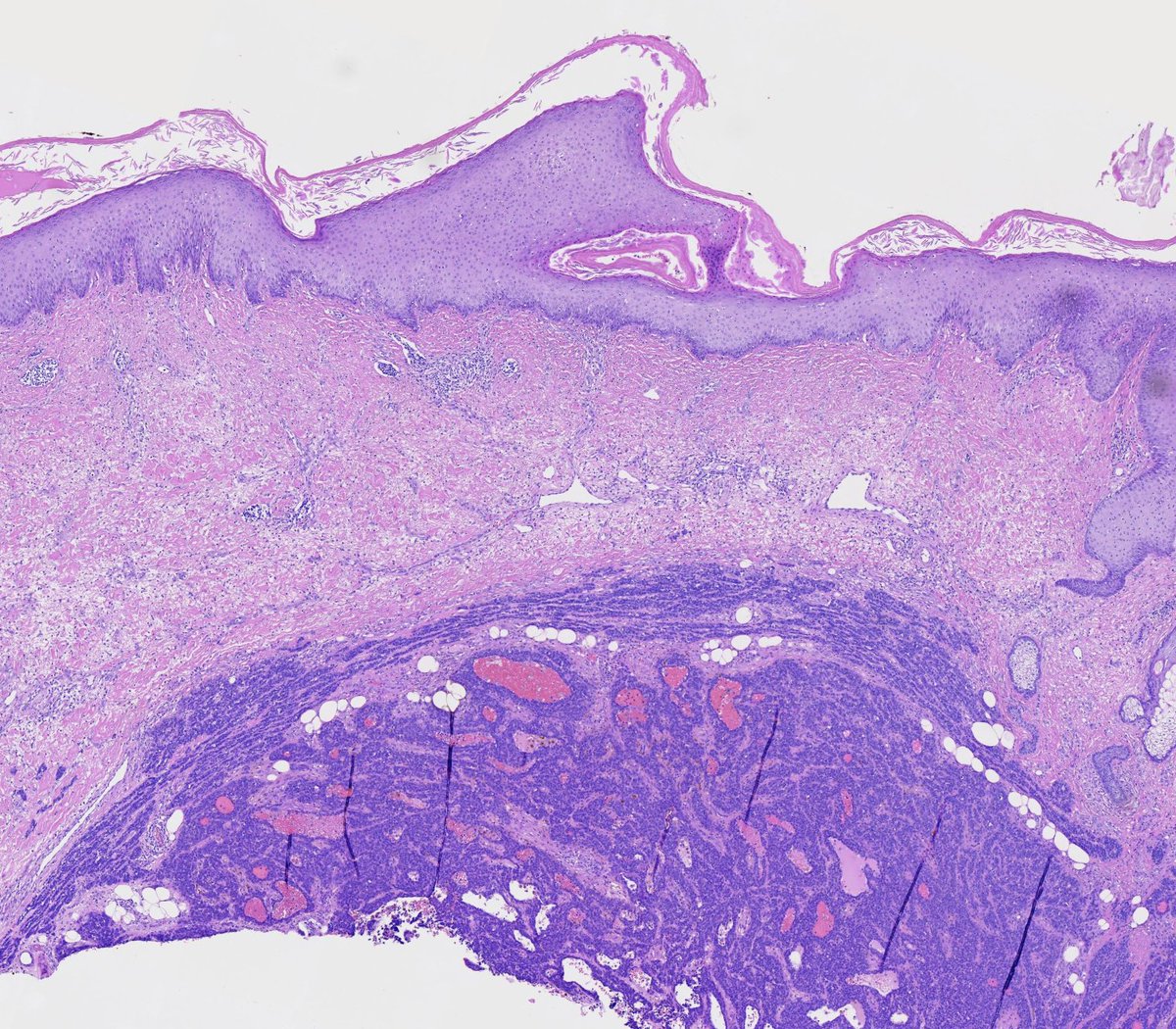 Toby Schmitt, MD tweet media