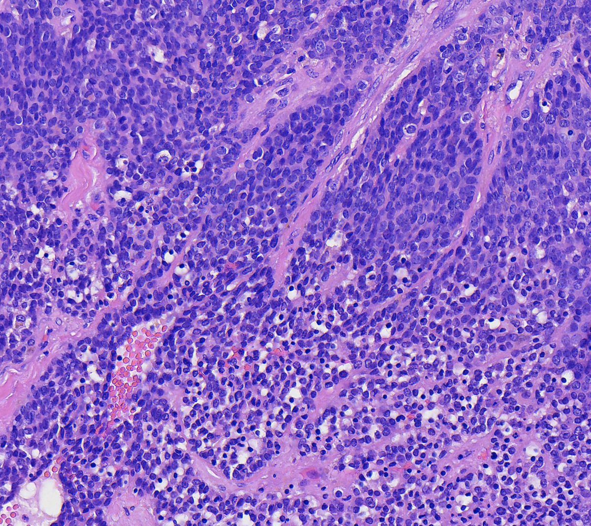 Toby Schmitt, MD tweet media