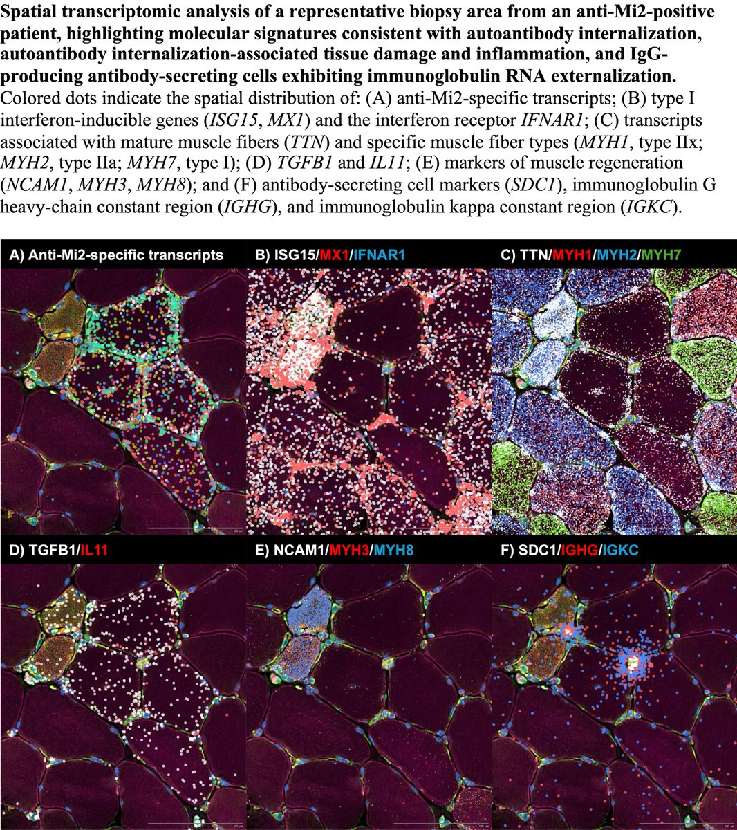 Iago Pinal-Fernandez tweet media