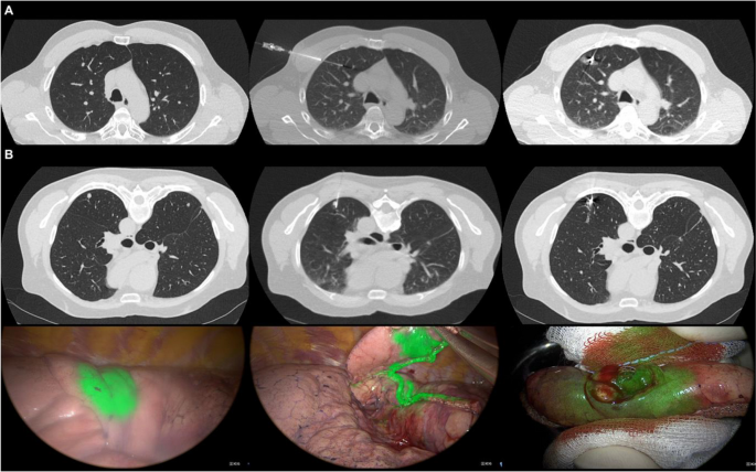 CVIR Oncology tweet media