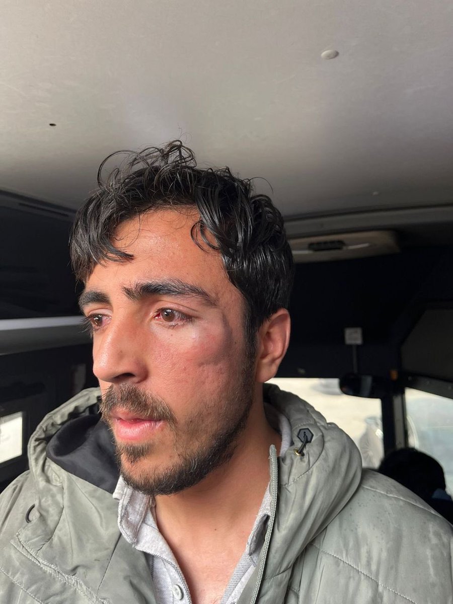 Burası Gazze değil burası Filistin değil 
Burası 
Yeni Türkiye 
Yazıklar olsun 
Bu mübarek ramazan ayında bu zulüm yapılırmı 
Zalimler Allah’a hesap verecek…

RamazanBrandasına SertMüdahale
#BatmanEmniyeti