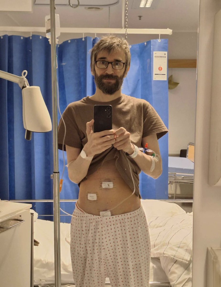 WHEN GROK SAVED A MAN’S LIFE AFTER HIS DOCTOR MISSED A NEAR RUPTURED APPENDIX

• A 49 year old man endured 24 hours of severe abdominal pain

• An ER visit ended with antacids and dismissal due to a “soft” abdomen

• Pain remained unbearable and worsened at home

• He