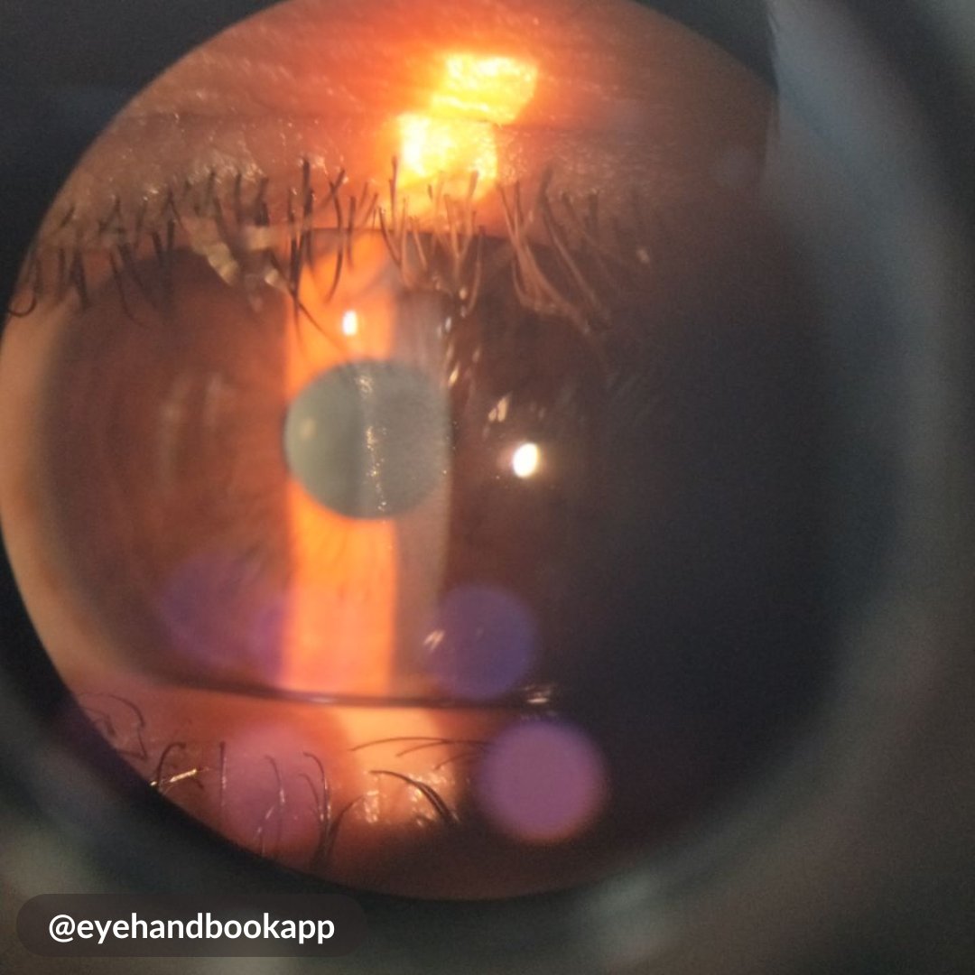 Eye Handbook tweet media