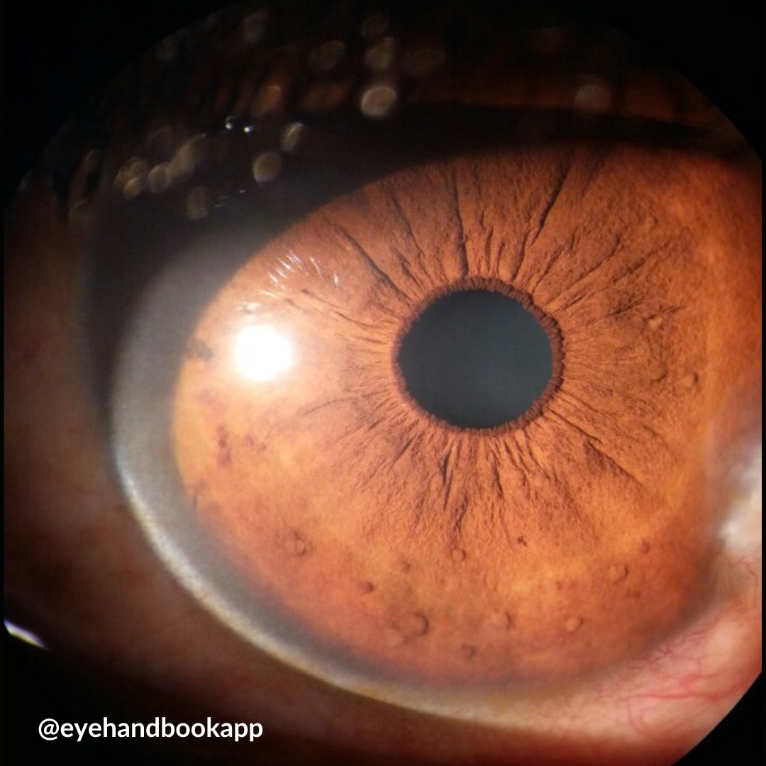 Eye Handbook tweet media