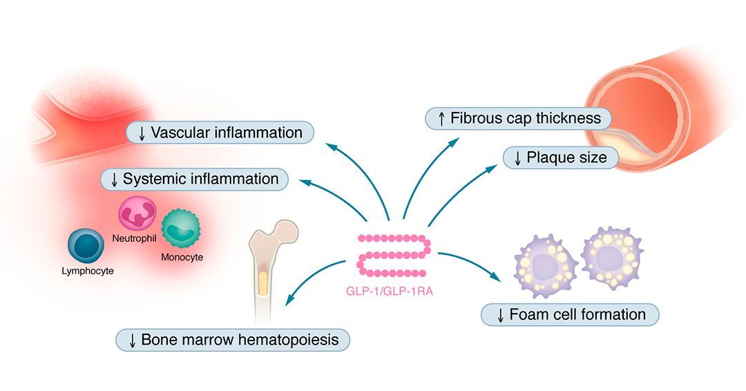 jclinicalinvest's tweet image. #GLP-1 and the #cardiovascular system

As part of JCI’s Review Series on Clinical Innovation and Scientific Progress in GLP-1 Medicine Florian Kahles, Andreas L. Birkenfeld, &amp;amp; Nikolaus Marx summarize the effects of GLP-1 and GLP-1RAs in the cardiovascular system as well as