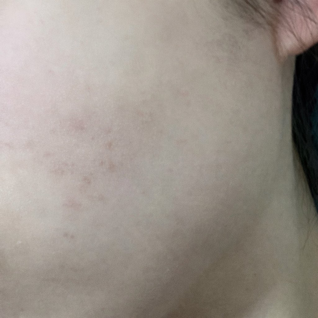 나뭇가지(상태:좋음) tweet media