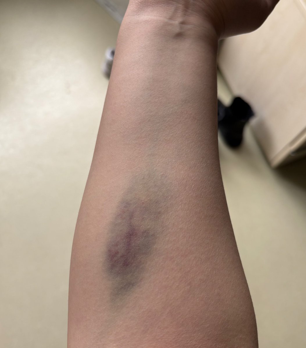 amk kollarımın haline bak rengarenk takılıyorum (ayrıca ilk fotoda belli zaten çok yanlış yerden almaya çalıştığı