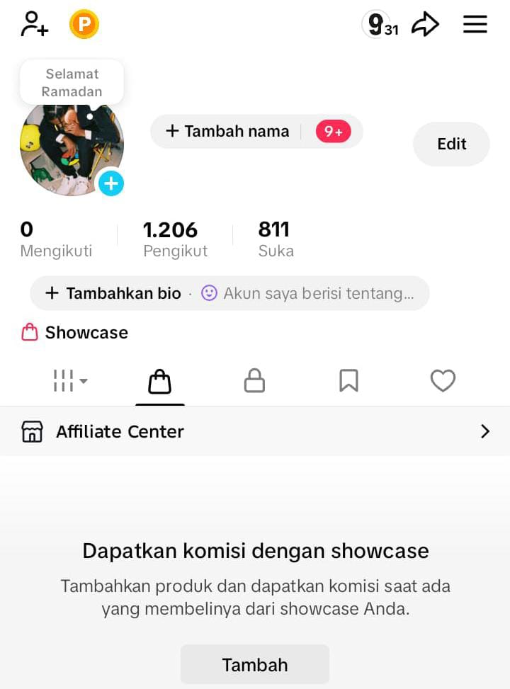 uiolatte's tweet image. WTS ACC TIKTOK F1K

★ akun y2026
★ folls hasil fyp
★ live on 3 fitur 
★ affiliate on 

price on alt

#zonauang