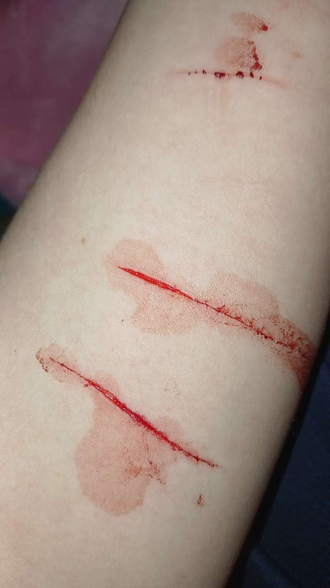 nameless00811's tweet photo. Trying to get deeper ! Not that many but yeah #selfharm #triggerwarning #trigger #sh https://t.co/J0RUIzzarD