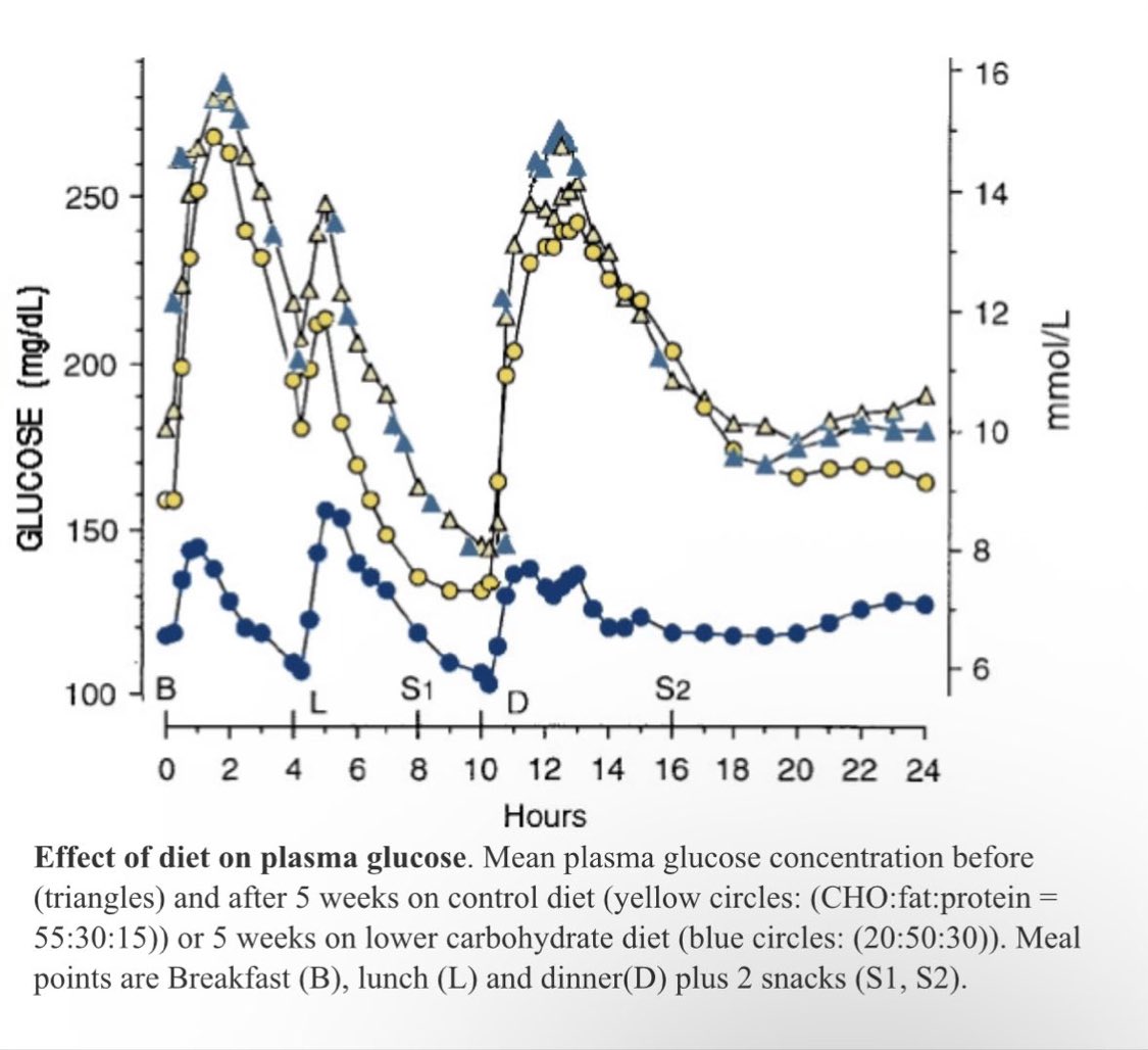 whitfieldlewis6's tweet image. As a stroke neurologist, a significant portion of the patients I see have diabetes or severe insulin resistance.

Chronic hyperglycemia damages blood vessels.
It injures the endothelium and glycocalyx.
It accelerates atherosclerosis.

And almost invariably, when I ask what they