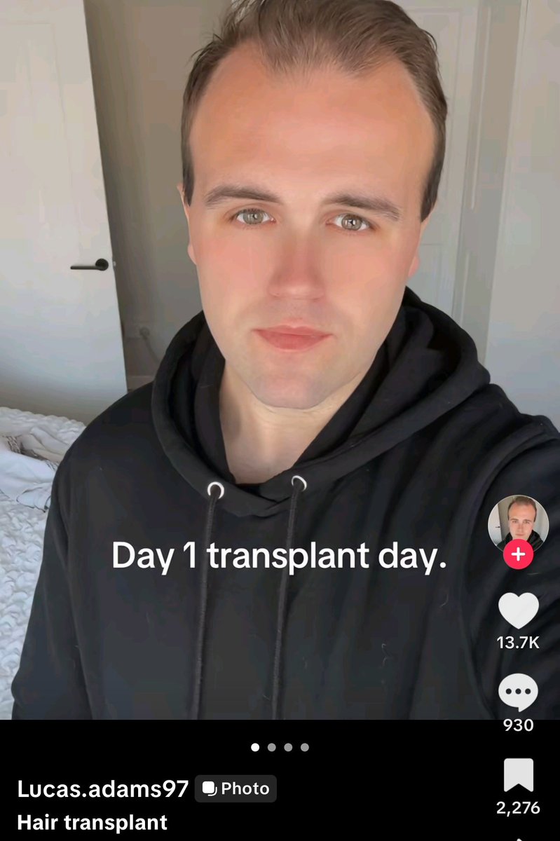 💔🤍🐐 🩷 tweet media