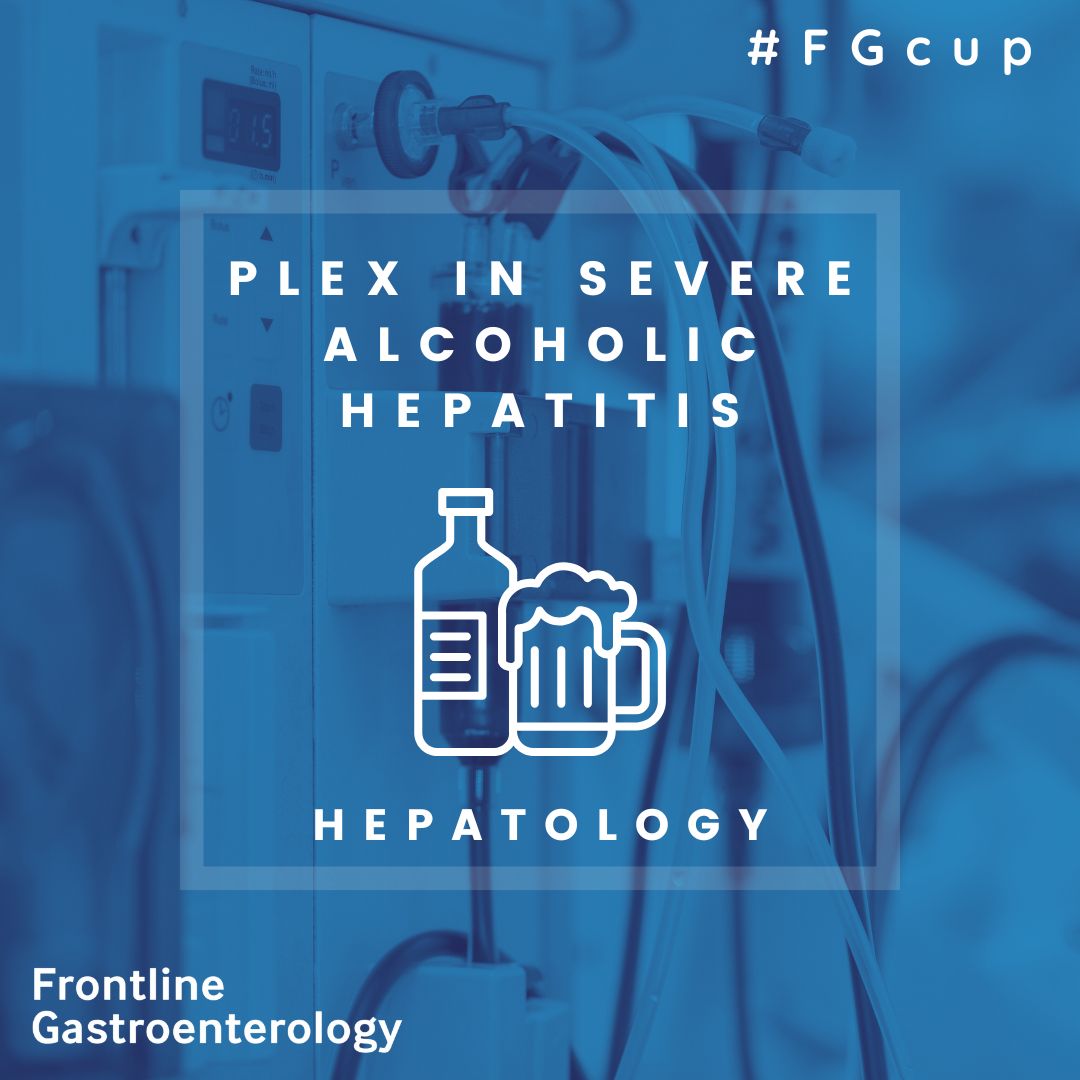 FrontGastro_BMJ's tweet photo. π§ Editorsβ Choice | #FGcup ππ - Semi Final!
Therapeutic plasma exchange in severe alcohol-associated hepatitis
Why this matters:
Severe alcohol-associated hepatitis (AAH) complicated by ACLF carries extremely high short-term mortality, and effective therapeutic options remain limited.
Key takeaways:
β’ Primary, prospective multicentre data in severe AAH precipitating ACLF
β’ Demonstrates feasibility and safety of therapeutic plasma exchange
β’ Provides real-world insight into patient selection and early response assessment
Why the editors picked it:
A high-quality original study addressing a major unmet need in the management of severe alcoholic hepatitis, where treatment options are few and outcomes are poor.
π FG Cup contender β voting opens soon
π Link to paper here
https://t.co/D98S76LhEY
π Frontline Gastroenterology
@PhilSmithIsBack @OTavabie @dr_aditi_kumar @TrevorTabone
@eathar_s @IrenePerezMD @KGananandan @zare_benjamin @medicalreg @dtleiberman
@EASLedu @BASLedu @AASLDtweets @amarnath7 @nmurug