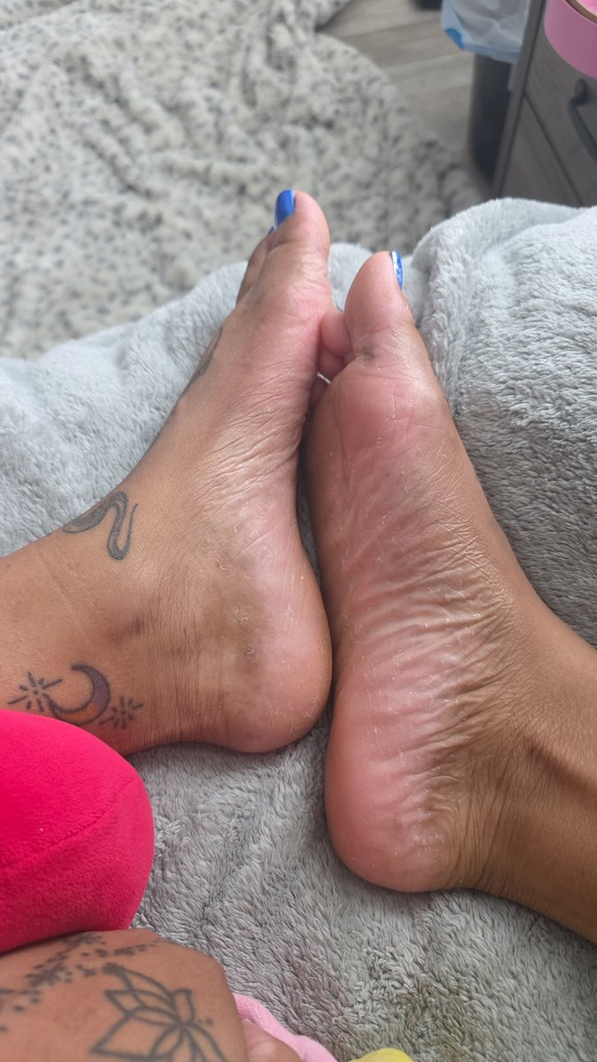 LotsuToes's tweet photo. #feetworshi̇p #toes #feet https://t.co/e1Adr4fyFu