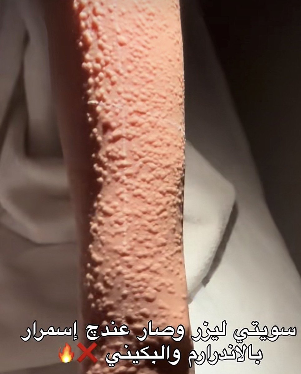 الدِيـم tweet media