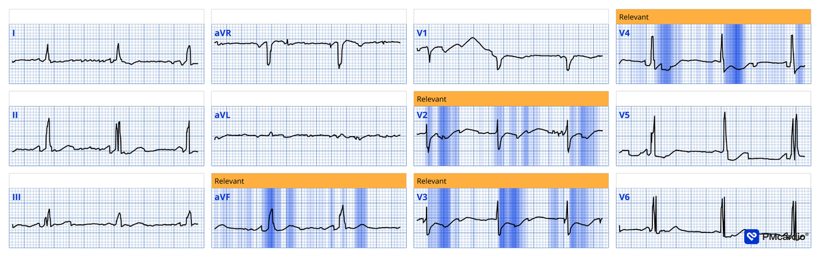 POCUS Med Ed tweet media