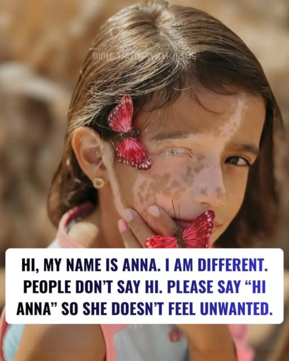 Being different doesn’t mean being less. Say hi to Anna, and to every child who just wants kindness ❤️