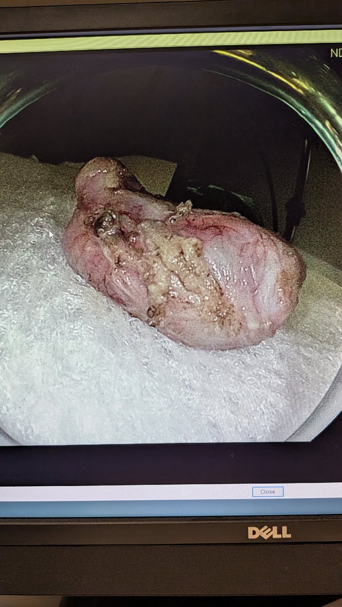 Prashant Kedia MD, FACG, FASGE tweet media