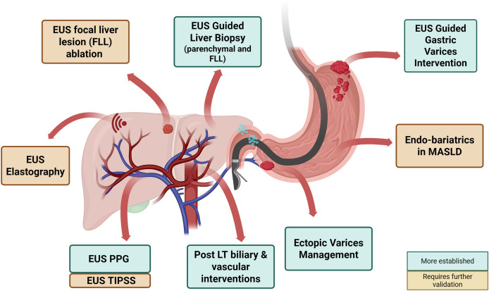 AGA_GHAdvances's tweet image. Endohepatology unites #hepatology &amp;amp; #endoscopy 🤝 EUS enables biopsy, portal pressure, variceal therapy &amp;amp; much more ➡️ Promise needs to meet pragmatism as innovation is balanced with safety &amp;amp; evidence ⚖️
🔗 ow.ly/1QuB50Yhj2N
🏷️ #GutHealth