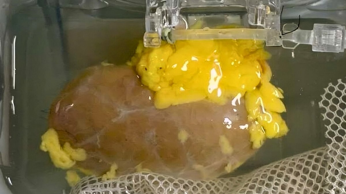 forallcurious's tweet photo. Breakthrough🚨: Scientists created a 'Universal' kidney to match any blood type! https://t.co/F0Z9Z8p9RS