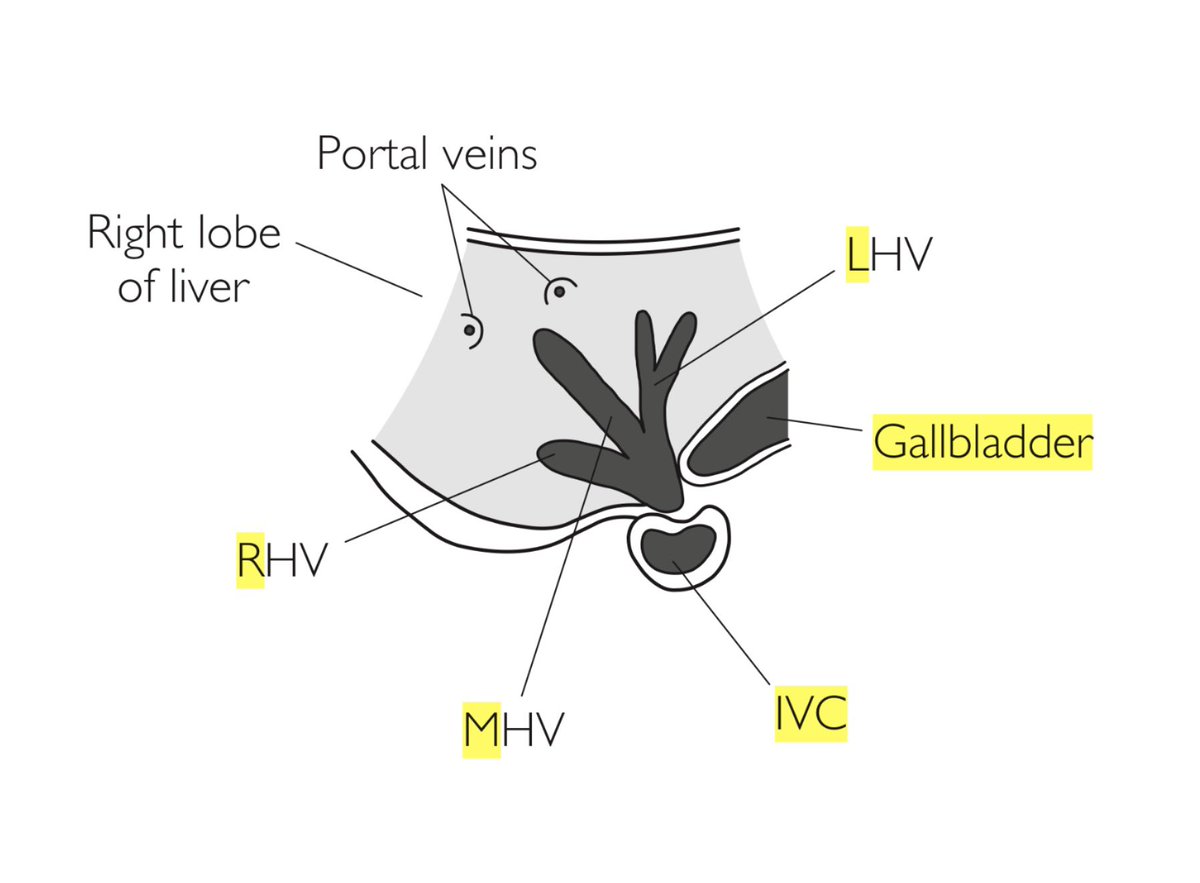 POCUSpeek's tweet photo. Deep breath in &amp; at the same time angle the probe cranially under the costal margin 👇 [from 📕Practical ultrasound, an illustrated guide - Jane Alty &amp; Edward Hoey] 🤩 #POCUS #ultrasound #fusic #famus #FOAMEd https://t.co/W7Pg5rqJAo
