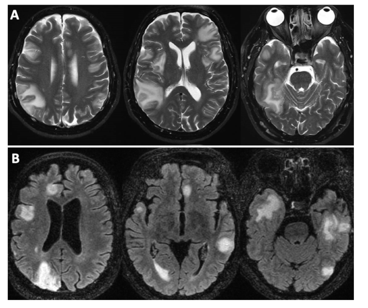 Practical Neurology tweet media